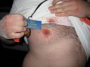 Bloodery Tits